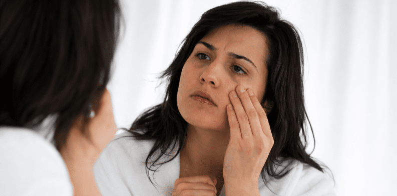 Dark circle and Dark Lips Treatment in Mohali