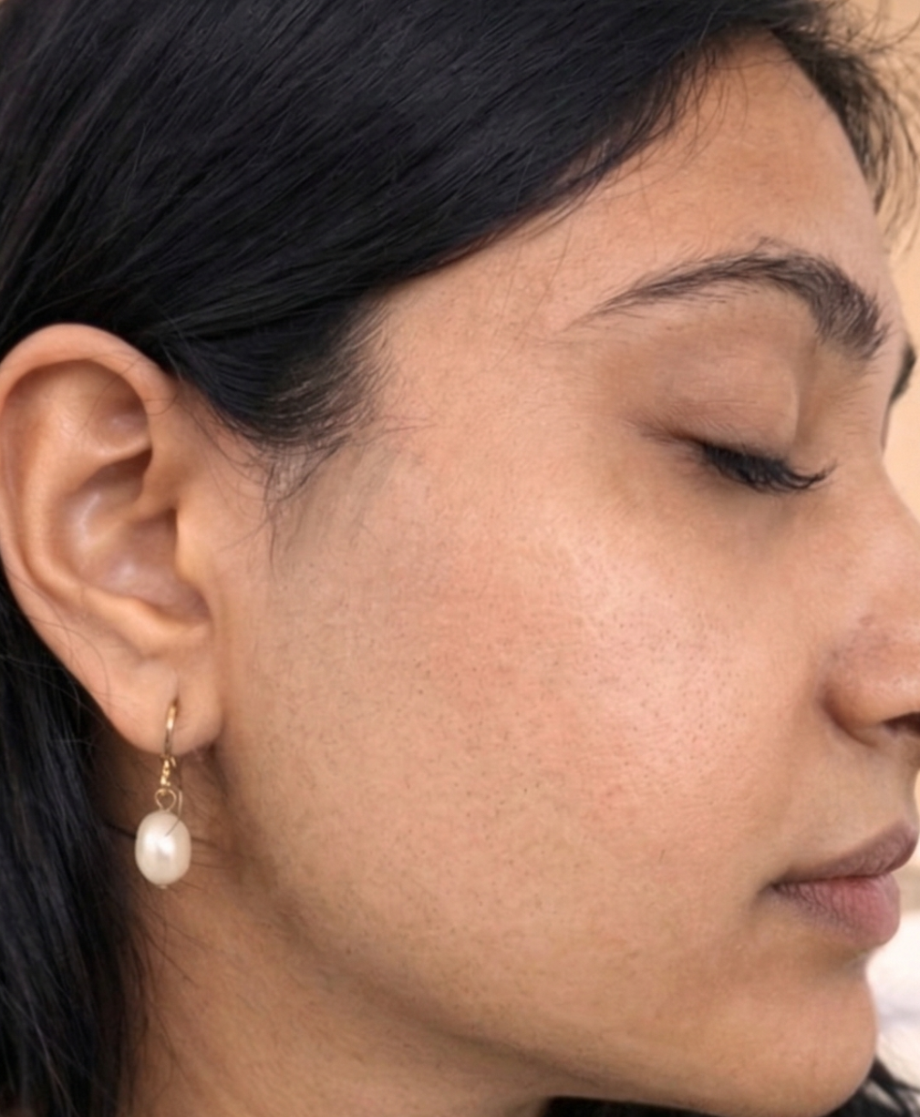 Laser Hair Removal Treatment After Results