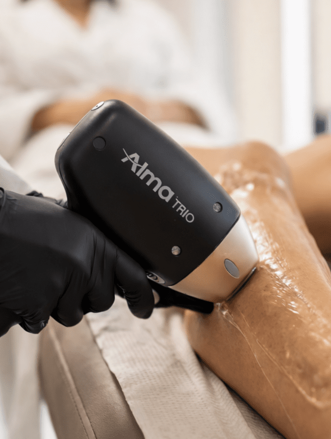 Laser Hair Removal in Chandigarh