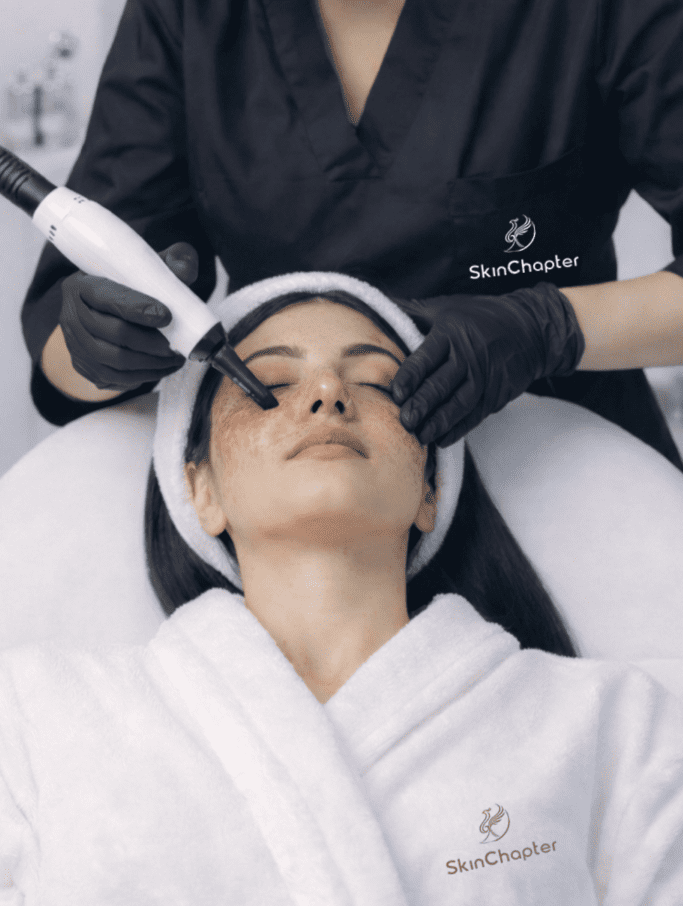 Pigmentation Treatment in Chandigarh