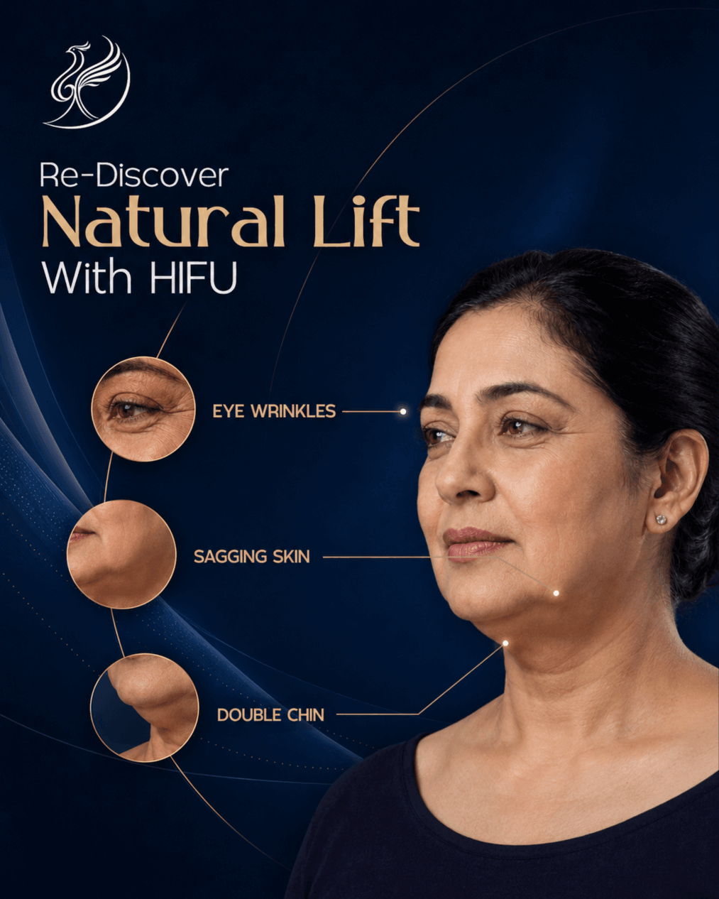 HIFU treatment in Mohali